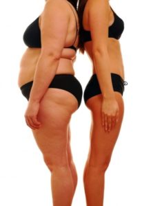 Plastic Surgery in Nashville, TN